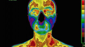 Full Body Thermography