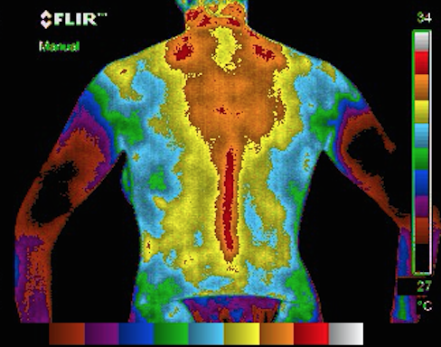 full body thermography
